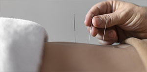 บริการฝังเข็ม แพทย์แผนจีน  และแพทย์แผนไทย บำบัดรักษาโรคด้วยแพทย์ทางเลือก